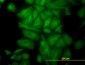 TUBA4A / TUBA1 Antibody (clone 2E11)